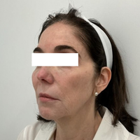 SohoDerm
