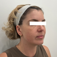 SohoDerm