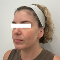 SohoDerm