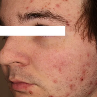 SohoDerm
