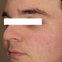 SohoDerm