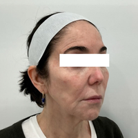 SohoDerm