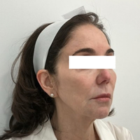 SohoDerm