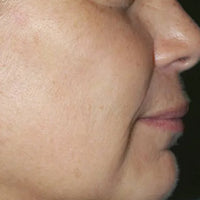 SohoDerm