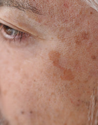 SohoDerm