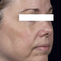 SohoDerm