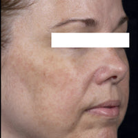 SohoDerm