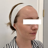 SohoDerm