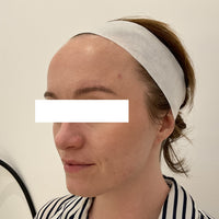 SohoDerm
