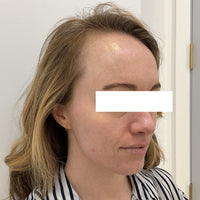 SohoDerm