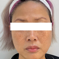 SohoDerm