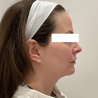 SohoDerm