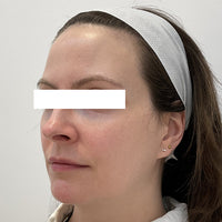 SohoDerm