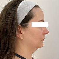 SohoDerm