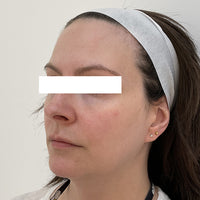SohoDerm