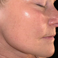SohoDerm