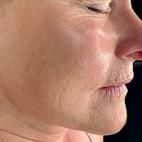 SohoDerm