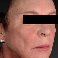 SohoDerm