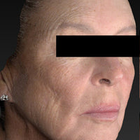 SohoDerm