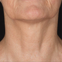 SohoDerm