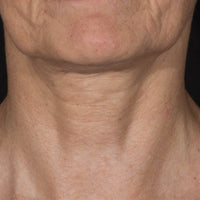 SohoDerm