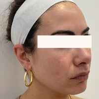 SohoDerm