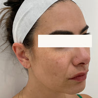SohoDerm