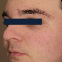 SohoDerm