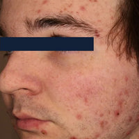 SohoDerm