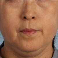 SohoDerm